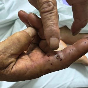 广西一养蛇场被洪水冲毁,约900条蛇出逃,被毒蛇咬伤村民:在家清理垃圾时手指被咬,打血清后手仍是肿的,在村中看到多条蛇-八博网