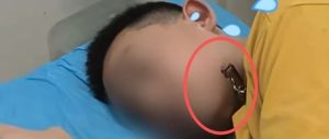 危险!12岁男孩湖边玩耍,被它一口“咬”脸......-八博网